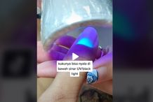 Dokter RSA UGM Beri Tanggapan Soal Kuku Penyintas Covid Menyala di Bawah Sinar UV Kuku Menyala