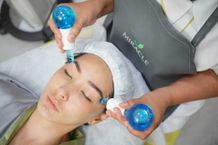 Sensasi Panas & Dingin, Facial Favorit Selebriti Hollywood Hadir di Miracle Aesthetic Clinic Miracle Aesthetic Clinic