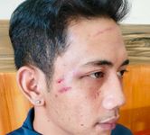 Pria Ini Diduga Jadi Korban Pengeroyokan Saat Melintas di Buleleng Kadek Jeni