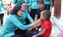 Cek Gigi Balita Secara Langsung, drg. Ida Mahendra Jaya Ingatkan Orangtua Larang Anak Konsumsi Makanan Mengandung Gula Berlebihan Cek Gigi Balita