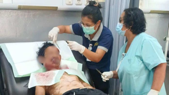 Kemanusiaan Diutamakan, RSUD Karangasem Tangani Korban KDRT Meski Terkendala Administrasi