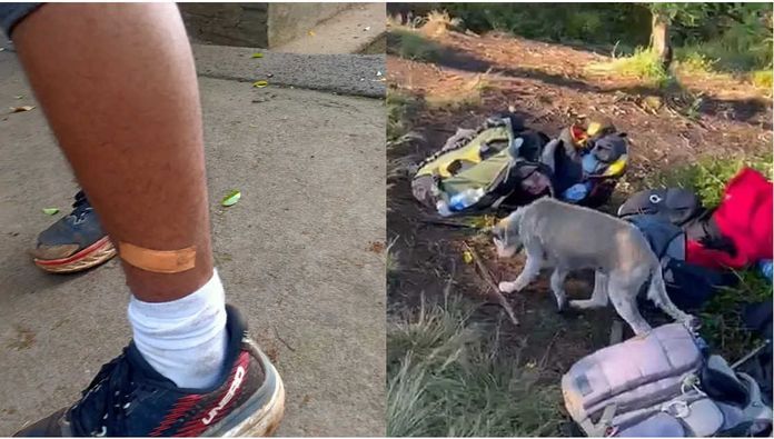 Dinkes Tabanan Pastikan Semua Korban Gigitan Anjing di Gunung Batukaru Dapatkan Penanganan Medis Sesuai Prosedur