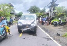 Lawan Arah Saat Menyebrang, Pelajar SMP di Rendang Alami Patah Tulang Lawan Arah Saat Menyebrang, Pelajar SMP di Rendang Alami Patah Tulang