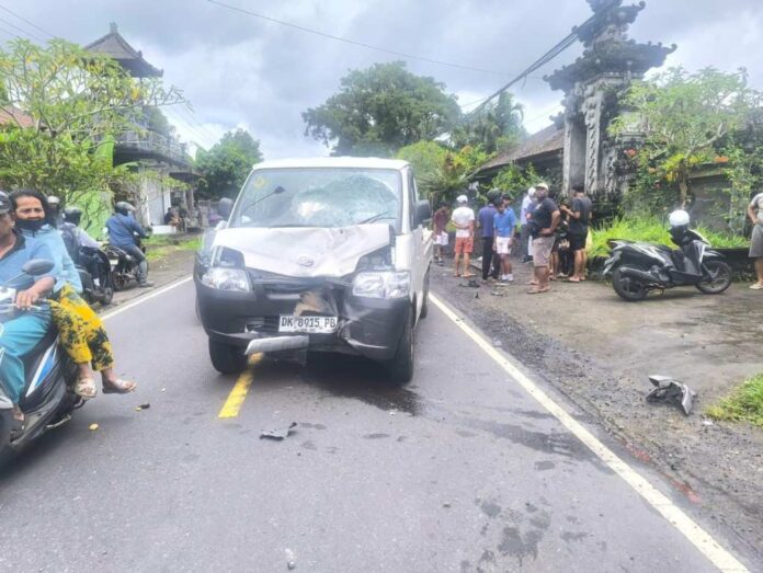 Lawan Arah Saat Menyebrang, Pelajar SMP di Rendang Alami Patah Tulang